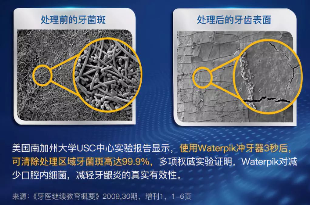 水做的牙线，用过的人都说后悔……后悔买晚了！